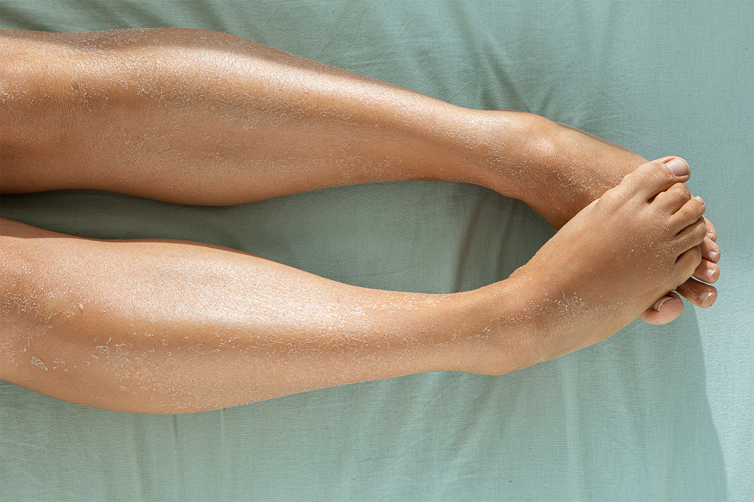 Dry Skin on Legs: The Cause(s) & Solution(s) 